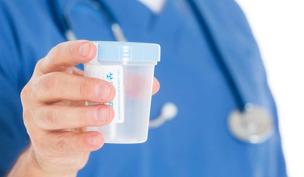 Observed Collection Procedures for DOT Direct Observations